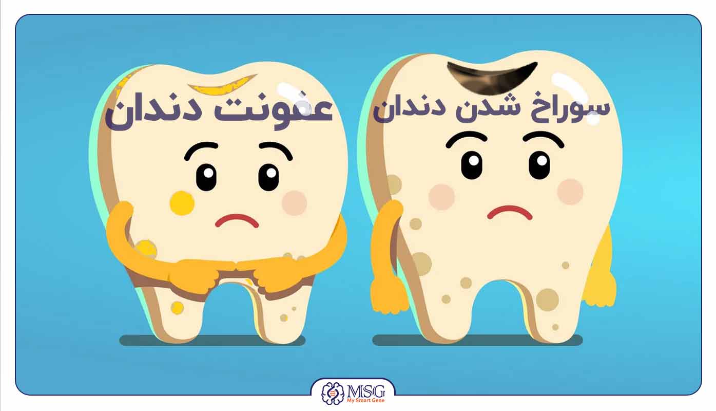 دندان خراب کودکان