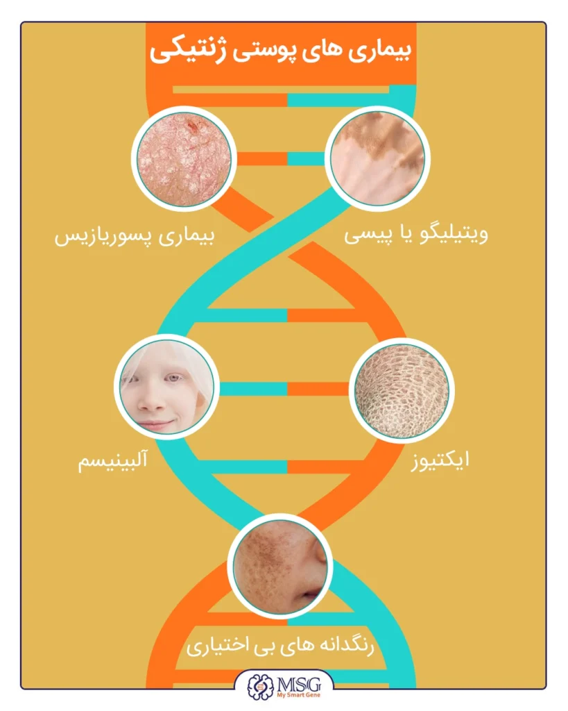 کدام بیماری پوستی خطرناک است؟