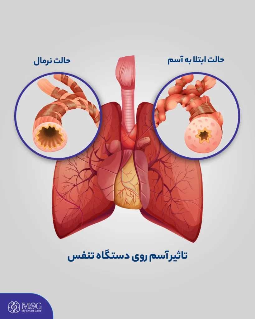 دستگاه تنفسی مبتلا به آسم در مقایسه با دستگاه تنفسی سالم