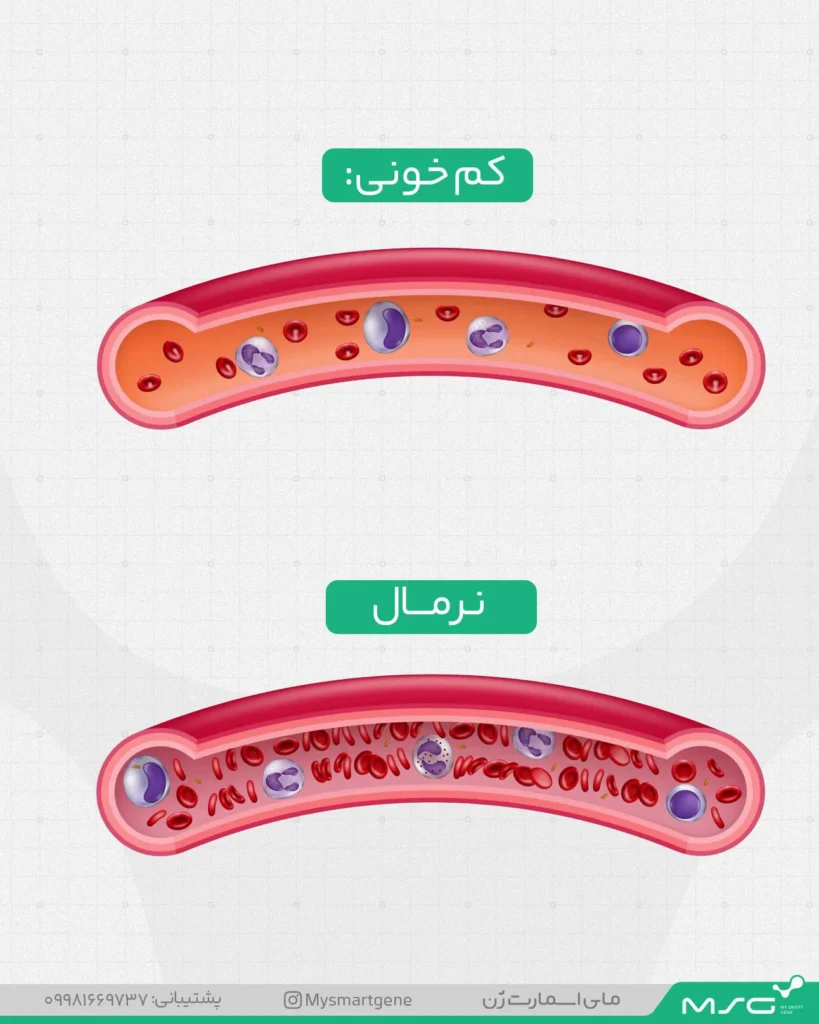 مقایسه یک فرد دچار کم خونی با شخصی نرمال