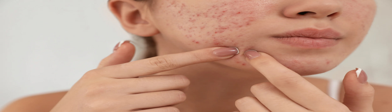 جوش ژنتیکی