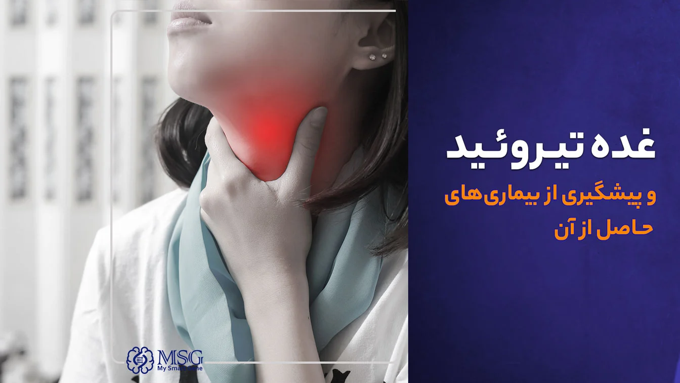 thyroid-gland