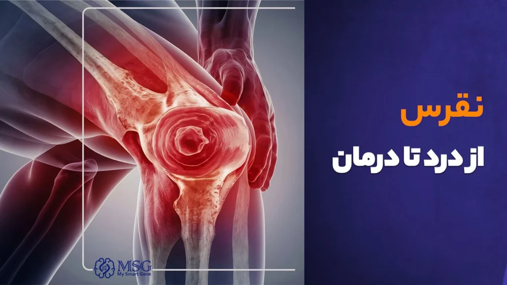بیماری نفرس و پیشگیری از آن