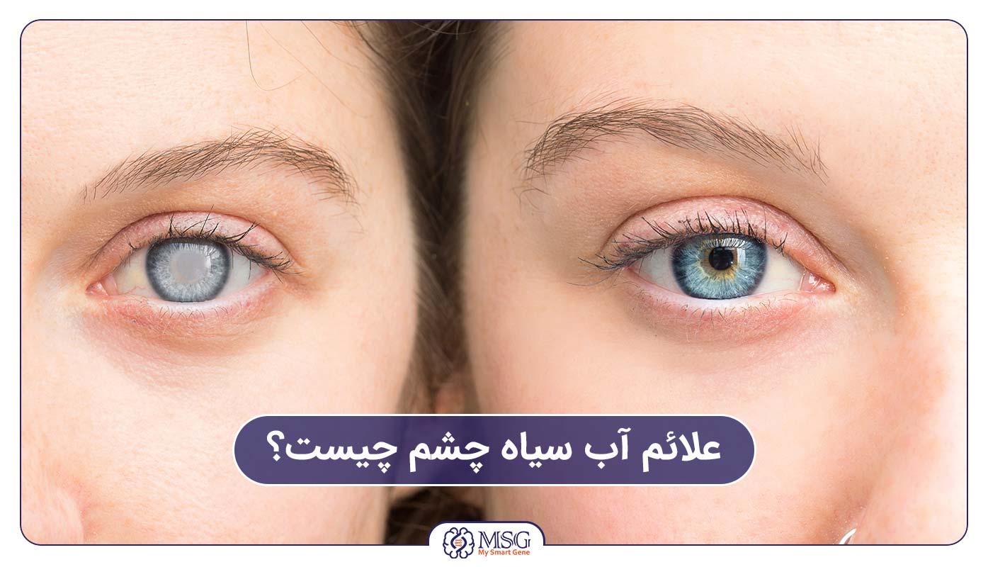 علائم آب سیاه چشم