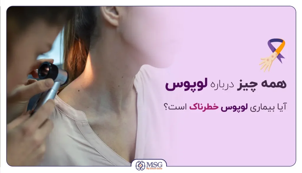 بیماری لوپوس