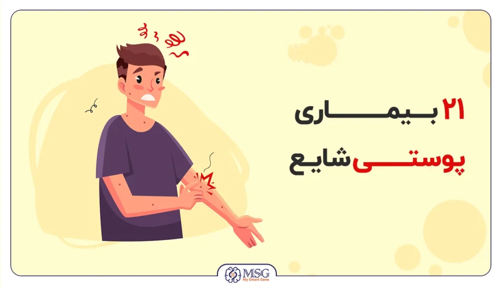شایع ترین بیماری های پوستی