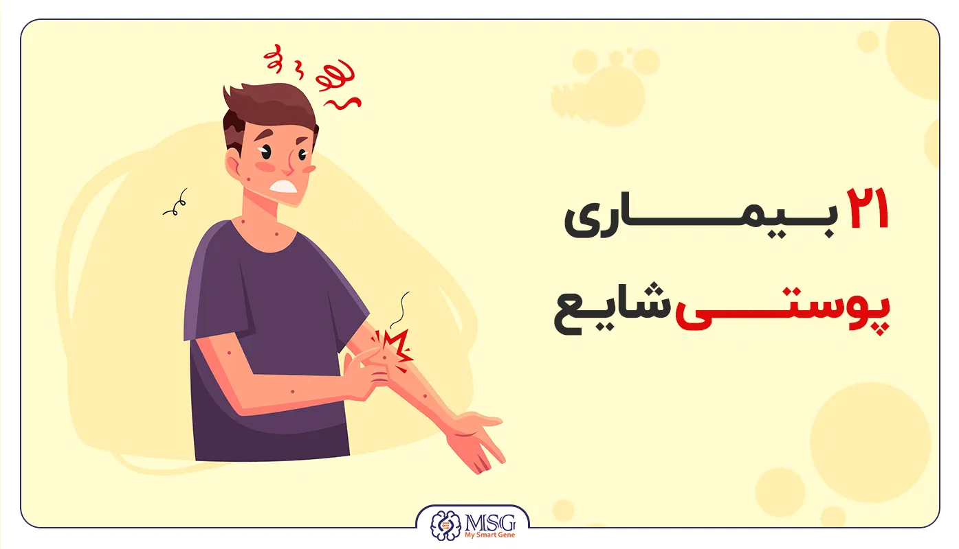 شایع ترین بیماری های پوستی