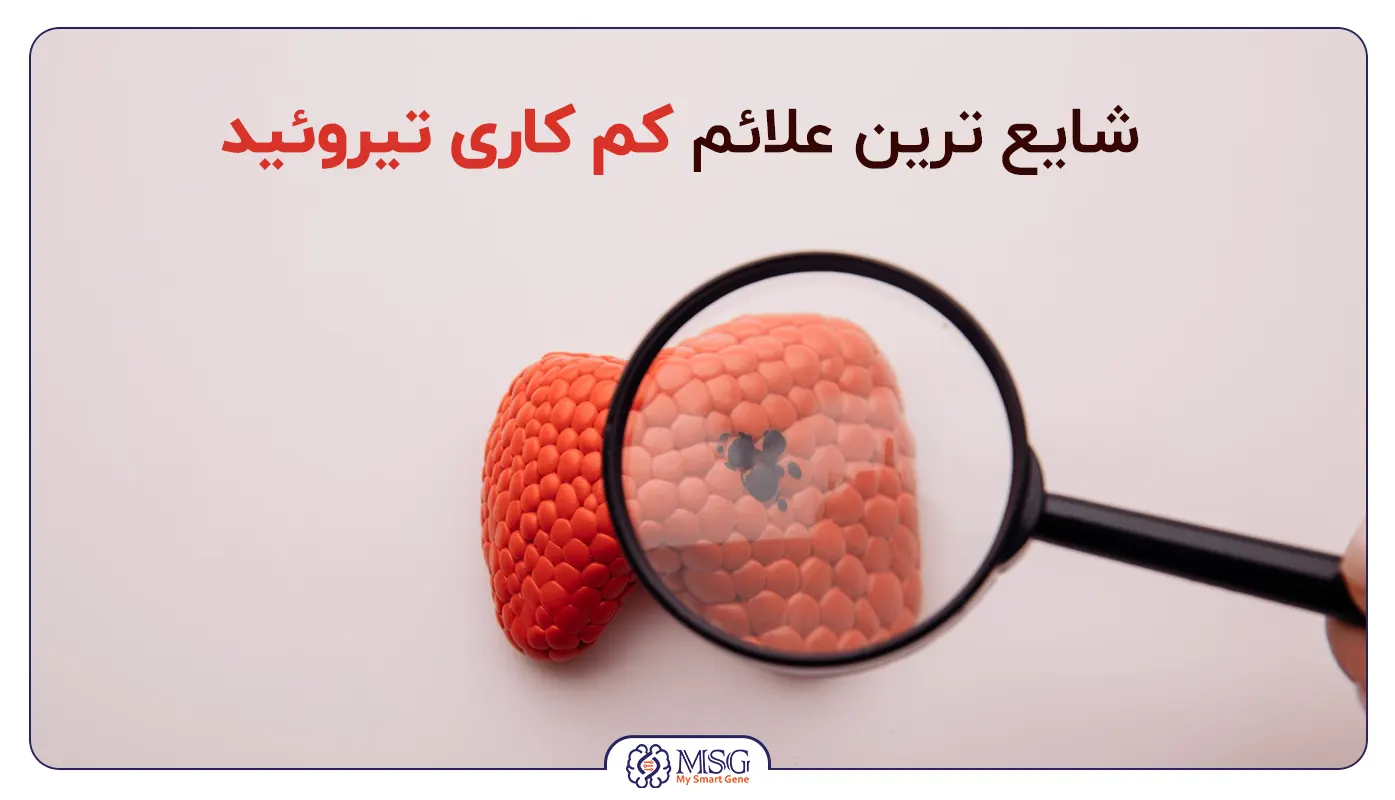 علائم کم کاری تیروئید