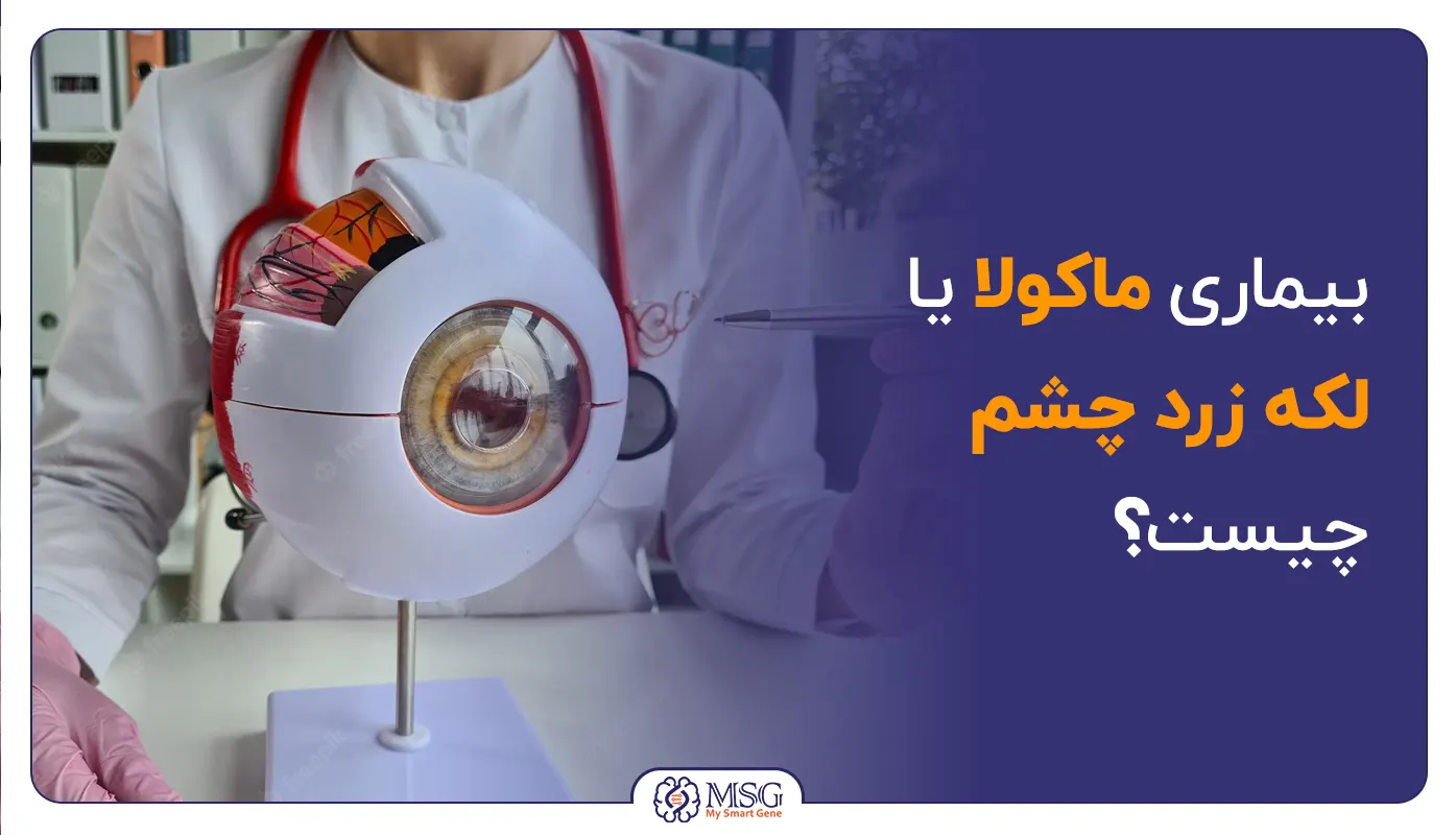 دژرانسیون ماکولا وابسته به سن