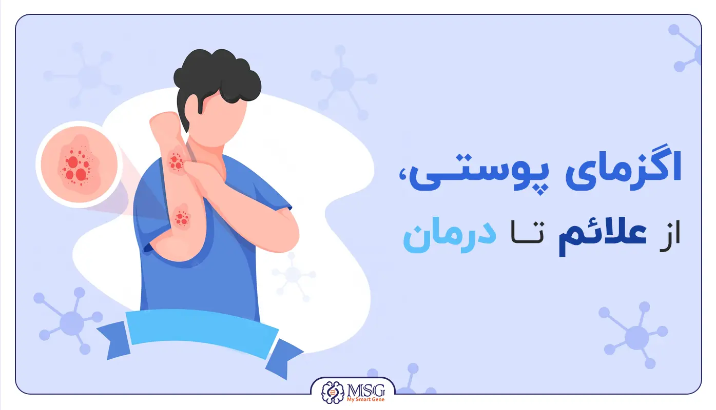 اگزما پوست
