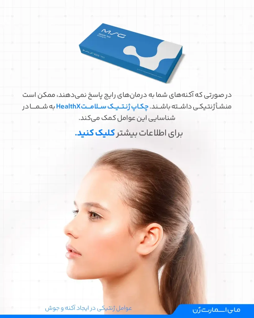 چکاپ ژنتیکی سلامت به شما در تشخیص جوش و آکنه ژنتیکی کمک میکند