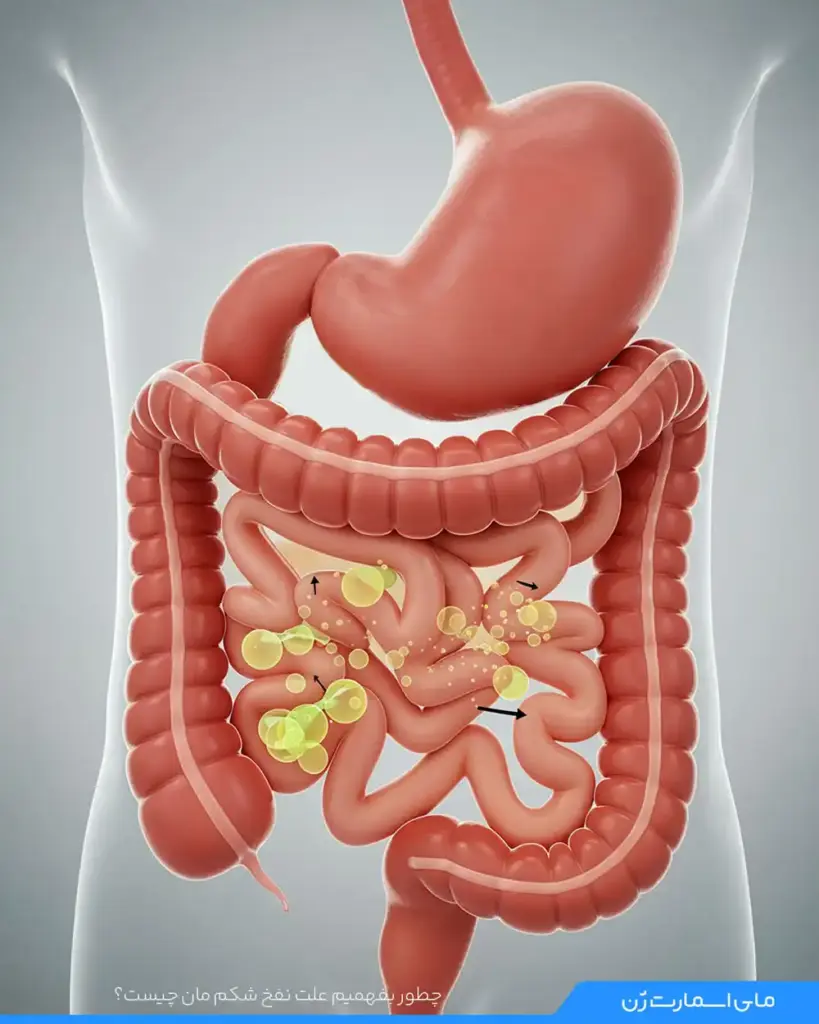 تصویری شماتیک از دستگاه گوارش انسان که مسیر حرکت مواد غذایی در روده و فرآیند هضم و جذب را با نشانه‌های گرافیکی نشان می‌دهد
